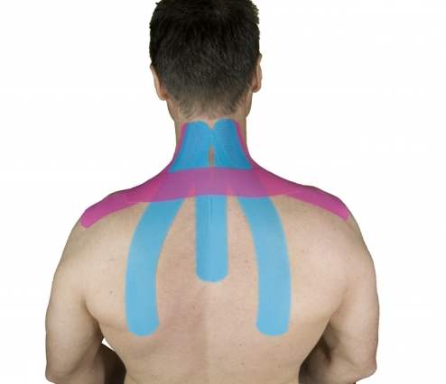 Kinesiotaping / Vendaje Neuromuscular