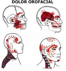 Dolor orofacial y trastornos de la Articulación temporomandibular